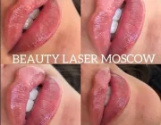 Центр косметологии и дерматологии Beauty Laser Фото 2 на сайте Sokolniki24.ru