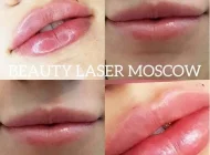 Центр косметологии и дерматологии Beauty Laser Фото 1 на сайте Sokolniki24.ru