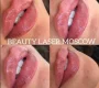 Центр косметологии и дерматологии Beauty laser Фото 2 на сайте Sokolniki24.ru